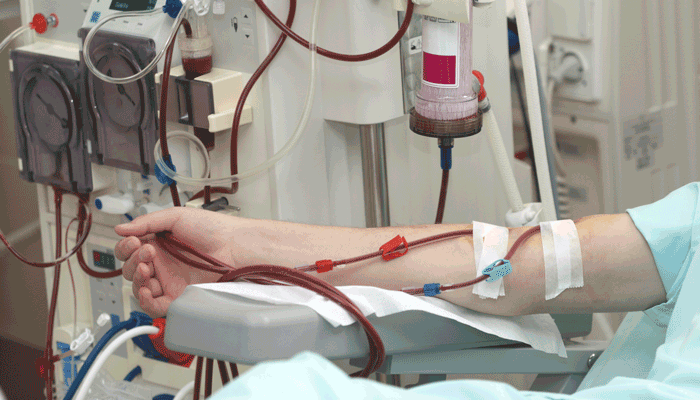 kidney dialysis